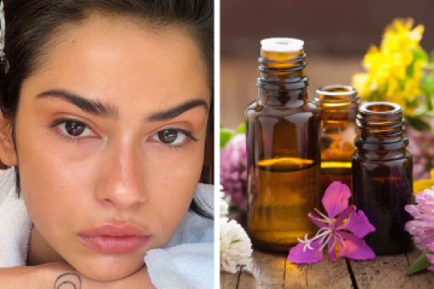 Dernier conseil beauté : Quelles solutions naturelles pour traiter les microkystes ?