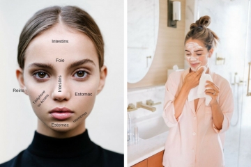 Le face-mapping pour comprendre ses problèmes de peau