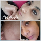 Swatch de W.eel : Modeling Bloomea, Bloomea