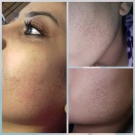 Swatch de W.eel : Modeling Bloomea, Bloomea