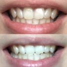 Swatch de MarineBlmy : Dentifrice au charbon Bicare Gifrer® Plus, Gifrer