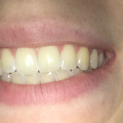 Swatch de leabeautyfr : Dentifrice au charbon Bicare Gifrer® Plus, Gifrer