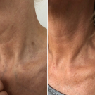 Swatch de Domicgy _beauty_test : Crème correctrice et protectrice rides & taches SPF20, Dr Pierre Ricaud