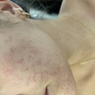 Swatch de Clem0310 : Retinol Clearing Oil, Dermalogica