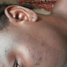 Swatch de likzo : Soin Intense Anti-Imperfections ACT-5, Nubiance Dermocosmétique