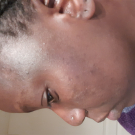 Swatch de likzo : Soin Intense Anti-Imperfections ACT-5, Nubiance Dermocosmétique