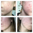 Swatch de alizeyyy : Retinol Clearing Oil, Dermalogica