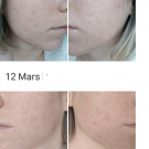 Swatch de Svona94 : Retinol Clearing Oil, Dermalogica