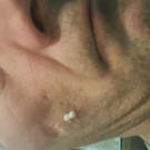 Swatch de fred33230 : Soin Intense Anti-Imperfections ACT-5, Nubiance Dermocosmétique