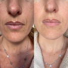 Swatch de Stfp69 : Sérum Botanique Booster Éclat Anti-Taches - Perfect Pisum, Saeve