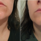 Swatch de system-of-the-rock : Soin global Normalina, Dermina