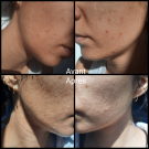 Swatch de Samanthahssn : Rapid Reveal Peel, Dermalogica