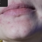 Swatch de Euqilegna63 : Soin global Normalina, Dermina