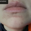 Swatch de Euqilegna63 : Soin global Normalina, Dermina