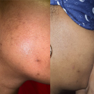 Swatch de Chocapik972 : Concentré Anti-taches, Nuhanciam