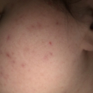 Swatch de cg_0208 : Soin global Normalina, Dermina