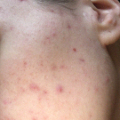 Swatch de cg_0208 : Soin global Normalina, Dermina