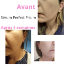 Swatch de Sika5210 : Sérum Botanique Booster Éclat Anti-Taches - Perfect Pisum, Saeve