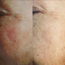 Swatch de Giniechablablablabla : Sérum Botanique Booster Éclat Anti-Taches - Perfect Pisum, Saeve