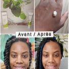 Swatch de Sika97 : Soin global Normalina, Dermina