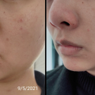 Swatch de mailinhlan54 : Soin global Normalina, Dermina