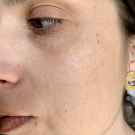 Swatch de lisoouuuiille : Soin global Normalina, Dermina