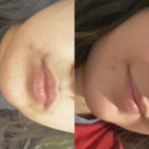 Swatch de Maayy : Soin Intense Anti-Imperfections ACT-5, Nubiance Dermocosmétique