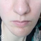 Swatch de the_green_framboise : Soin global Normalina, Dermina