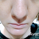 Swatch de the_green_framboise : Soin global Normalina, Dermina