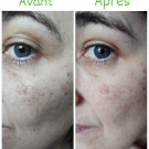 Swatch de L.avis.de.famille : Sérum Botanique Booster Éclat Anti-Taches - Perfect Pisum, Saeve