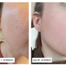 Swatch de Homesweetambre : Sérum Botanique Booster Éclat Anti-Taches - Perfect Pisum, Saeve