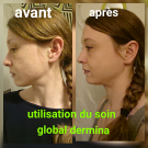 Swatch de attilatyron : Soin global Normalina, Dermina