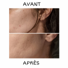 Swatch de Shadya : Soin global Normalina, Dermina