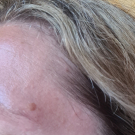 Swatch de vinoutaz : Soin Dépigmentant, Dermina