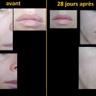 Swatch de urielh : Sérum Botanique Booster Éclat Anti-Taches - Perfect Pisum, Saeve