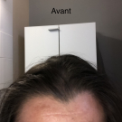 Swatch de Liliana69003 : Soin Dépigmentant, Dermina