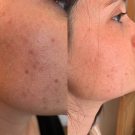 Swatch de Manon1990 : Soin Dépigmentant, Dermina