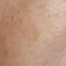 Swatch de regisa : Soin Dépigmentant, Dermina