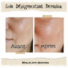 Swatch de Samm34 : Soin Dépigmentant, Dermina