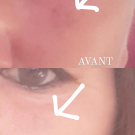 Swatch de Drass66 : Soin Dépigmentant, Dermina