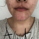 Swatch de Djoudi : MASQUE DÉSINCRUSTANT AU CHARBON ACTIF, Mademoiselle Agathe