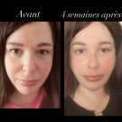 Swatch de MyBeauties.Blog : Soin Dépigmentant, Dermina