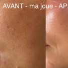 Swatch de Alyce : Masque New Angance x 2 pièces, NEW ANGANCE