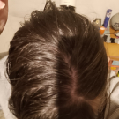 Swatch de Paillettes cosmiques : Shampooing apaisant sédacalm, ACM Laboratoire Dermatologique