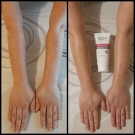 Swatch de Valbry : DÉPIWHITE LAIT CORPS, Laboratoire Dermatologique ACM