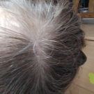 Swatch de missbot : NONOPHANE REACTIONAL, ACM Laboratoire Dermatologique