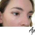 Swatch de ChoupnBeauty : Superdefense CC Cream SPF 30, Clinique