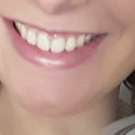 Swatch de Yoyo17 : Lip Dome, So Susan