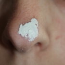 Swatch de peggy vanderhispallie : Pâte SOS Soin Local Hyséac, Uriage